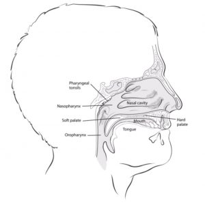 What Is Nasopharyngeal Cancer? - Craig's Story