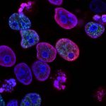 cancer cells